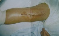 Patienten-Fotos-017 (1)