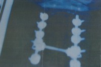 Patienten-Fotos-017 (2)