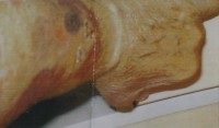 Patienten-Fotos-017 (3)