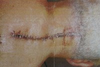 Patienten-Fotos-017